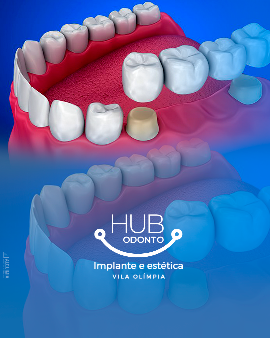 HubOdontoVilaOlimpia-Protocolo_dentário
