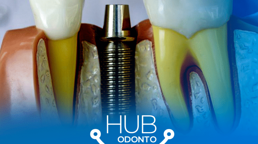 HubOdontoVilaOlimpia-Prótese