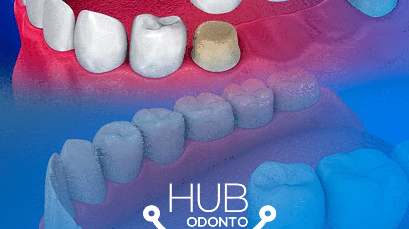 HubOdontoVilaOlimpia-Protocolo_dentário