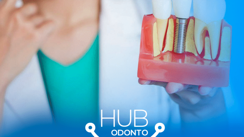 HubOdontoVilaOlimpia-Implantedental