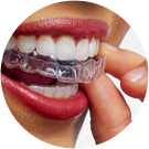 Invisalign dental - icone - 01 HubOdontoVilaOlimpia