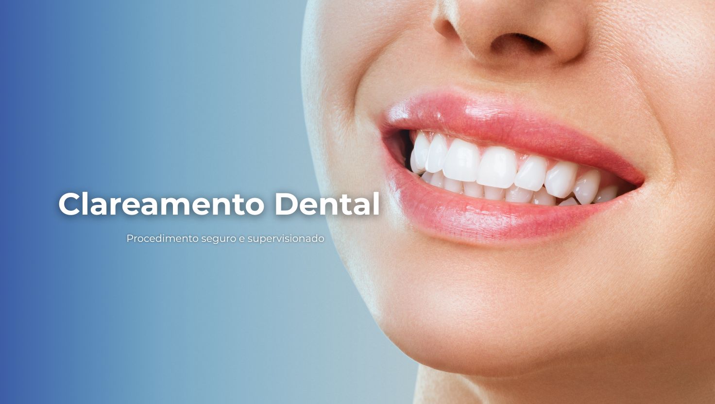Clínica Hub Odonto oferecendo clareamento dental seguro e eficaz