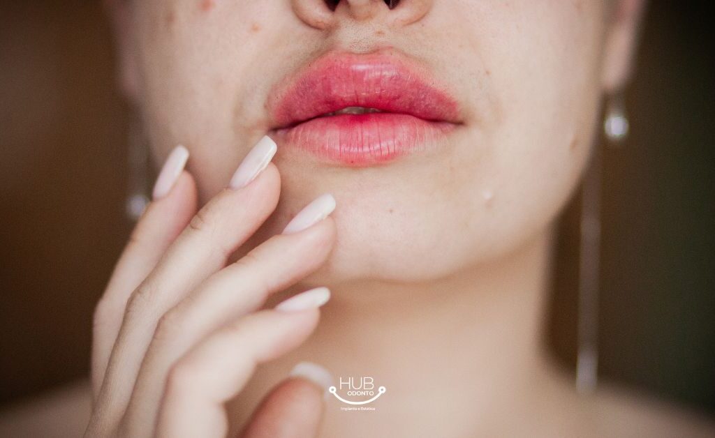 Preenchimento Facial e Labial na Vila Olímpia