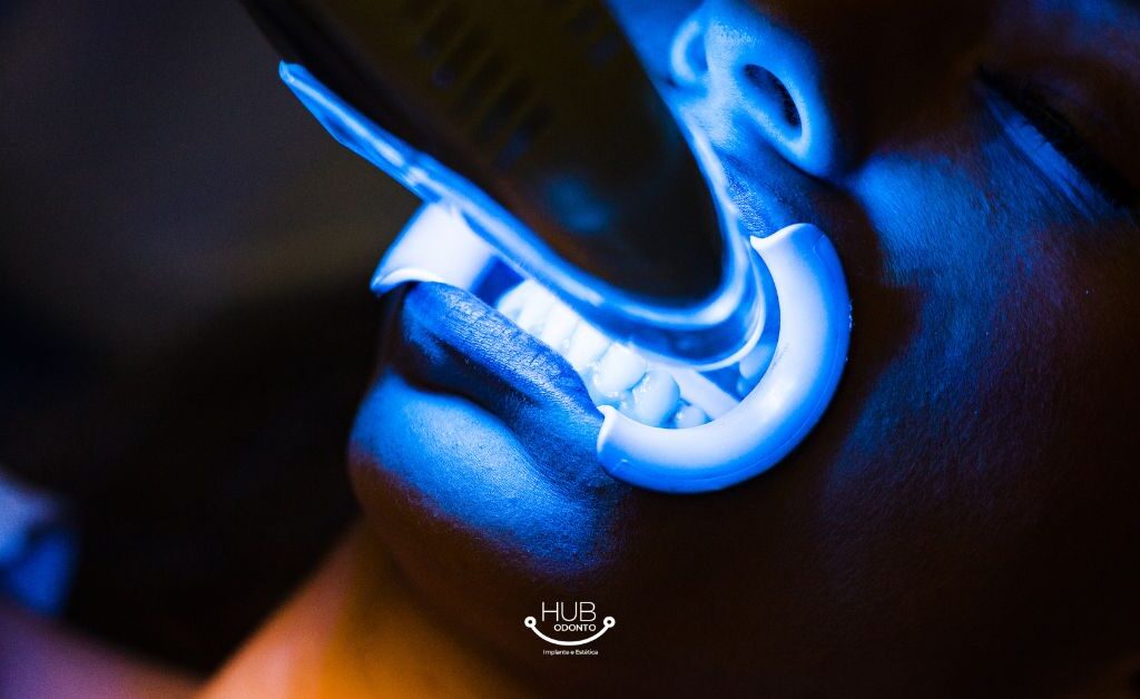 Nome do arquivo: clareamento-dental-hub-odonto-vila-olimpia.