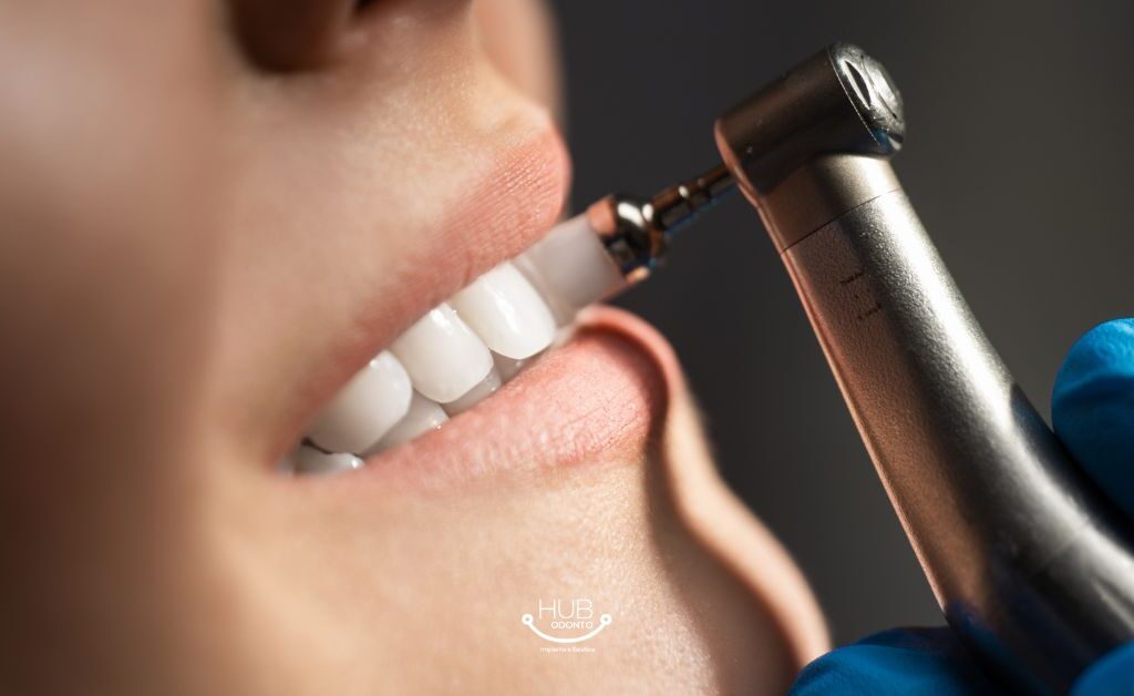 limpeza-dental-moema-hub-odonto.jpg